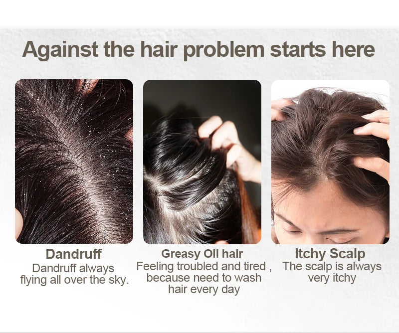 Refreshing Anti Dandruff Hair Shampoo Shiny Hair Scalp Treatment