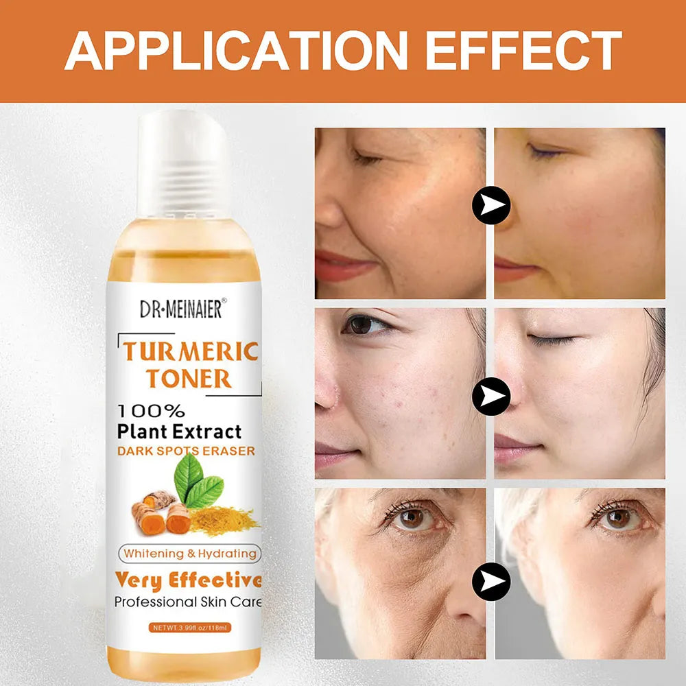 Turmeric Dark Spots Toner